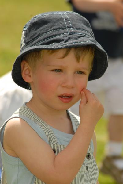 Premiers soleils et premiers coups de soleil